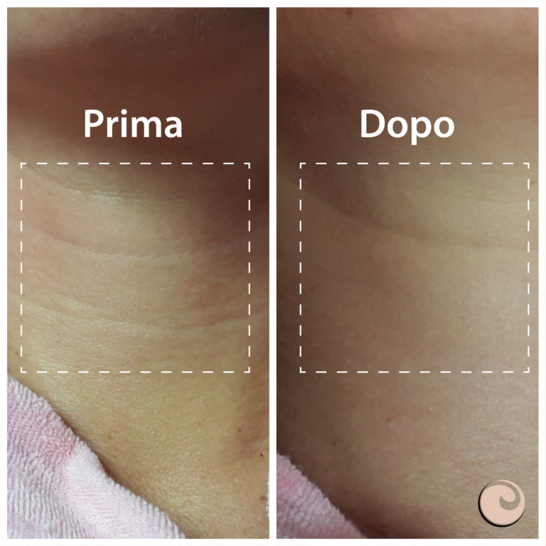 Prima e dopo Pro youth-01